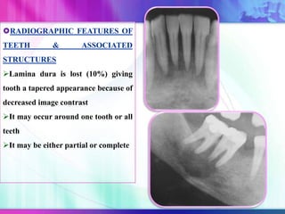 RADIOGRAPHIC FEATURES OF
TEETH & ASSOCIATED
STRUCTURES
Lamina dura is lost (10%) giving
tooth a tapered appearance because of
decreased image contrast
It may occur around one tooth or all
teeth
It may be either partial or complete
 