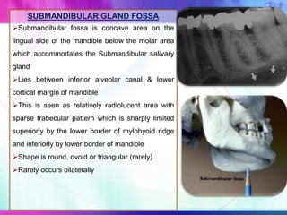 SUBMANDIBULAR GLAND FOSSA
Submandibular fossa is concave area on the
lingual side of the mandible below the molar area
which accommodates the Submandibular salivary
gland
Lies between inferior alveolar canal & lower
cortical margin of mandible
This is seen as relatively radiolucent area with
sparse trabecular pattern which is sharply limited
superiorly by the lower border of mylohyoid ridge
and inferiorly by lower border of mandible
Shape is round, ovoid or triangular (rarely)
Rarely occurs bilaterally
 