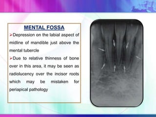 MENTAL FOSSA
Depression on the labial aspect of
midline of mandible just above the
mental tubercle
Due to relative thinness of bone
over in this area, it may be seen as
radiolucency over the incisor roots
which may be mistaken for
periapical pathology
 