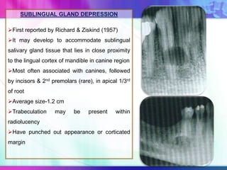 SUBLINGUAL GLAND DEPRESSION
First reported by Richard & Ziskind (1957)
It may develop to accommodate sublingual
salivary gland tissue that lies in close proximity
to the lingual cortex of mandible in canine region
Most often associated with canines, followed
by incisors & 2nd premolars (rare), in apical 1/3rd
of root
Average size-1.2 cm
Trabeculation may be present within
radiolucency
Have punched out appearance or corticated
margin
 