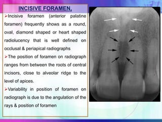 INCISIVE FORAMEN,
Incisive foramen (anterior palatine
foramen) frequently shows as a round,
oval, diamond shaped or heart shaped
radiolucency that is well defined on
occlusal & periapical radiographs
The position of foramen on radiograph
ranges from between the roots of central
incisors, close to alveolar ridge to the
level of apices.
Variability in position of foramen on
radiograph is due to the angulation of the
rays & position of foramen
 