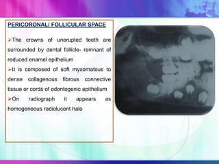 PERICORONAL/ FOLLICULAR SPACE
The crowns of unerupted teeth are
surrounded by dental follicle- remnant of
reduced enamel epithelium
It is composed of soft myxomatous to
dense collagenous fibrous connective
tissue or cords of odontogenic epithelium
On radiograph it appears as
homogeneous radiolucent halo
 