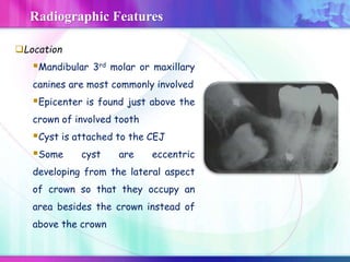 Location
Mandibular 3rd molar or maxillary
canines are most commonly involved
Epicenter is found just above the
crown of involved tooth
Cyst is attached to the CEJ
Some cyst are eccentric
developing from the lateral aspect
of crown so that they occupy an
area besides the crown instead of
above the crown
Radiographic Features
 