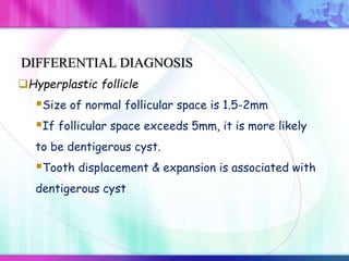 Hyperplastic follicle
Size of normal follicular space is 1.5-2mm
If follicular space exceeds 5mm, it is more likely
to be dentigerous cyst.
Tooth displacement & expansion is associated with
dentigerous cyst
DIFFERENTIAL DIAGNOSIS
 