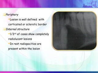 Periphery
Lesion is well defined with
corticated or sclerotic border
Internal structure
1/3rd of cases show completely
radiolucent lesions
In rest radiopacities are
present within the lesion
 