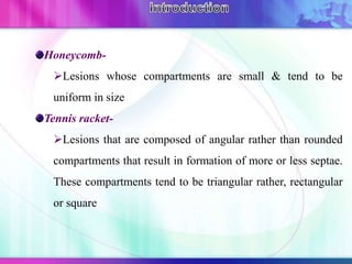 Honeycomb-
Lesions whose compartments are small & tend to be
uniform in size
Tennis racket-
Lesions that are composed of angular rather than rounded
compartments that result in formation of more or less septae.
These compartments tend to be triangular rather, rectangular
or square
 