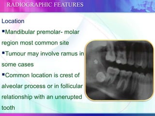 Location
Mandibular premolar- molar
region most common site
Tumour may involve ramus in
some cases
Common location is crest of
alveolar process or in follicular
relationship with an unerupted
tooth
RADIOGRAPHIC FEATURES
 