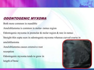 ODONTOGENIC MYXOMA
Both more common in mandible
Ameloblastoma is common in molar- ramus region
Odontogenic myxoma in premolar & molar region & rare in ramus
Straight thin septa seen in odontogenic myxoma whereas curved coarse in
ameloblastoma
Ameloblastoma causes extensive root
resorption
Odontogenic myxoma tends to grow in
length of bone
 
