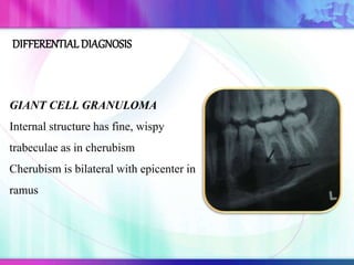 GIANT CELL GRANULOMA
Internal structure has fine, wispy
trabeculae as in cherubism
Cherubism is bilateral with epicenter in
ramus
DIFFERENTIAL DIAGNOSIS
 