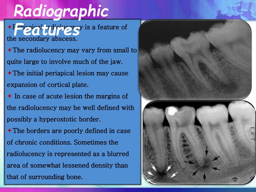 unilocular and multilocular radiolucencies