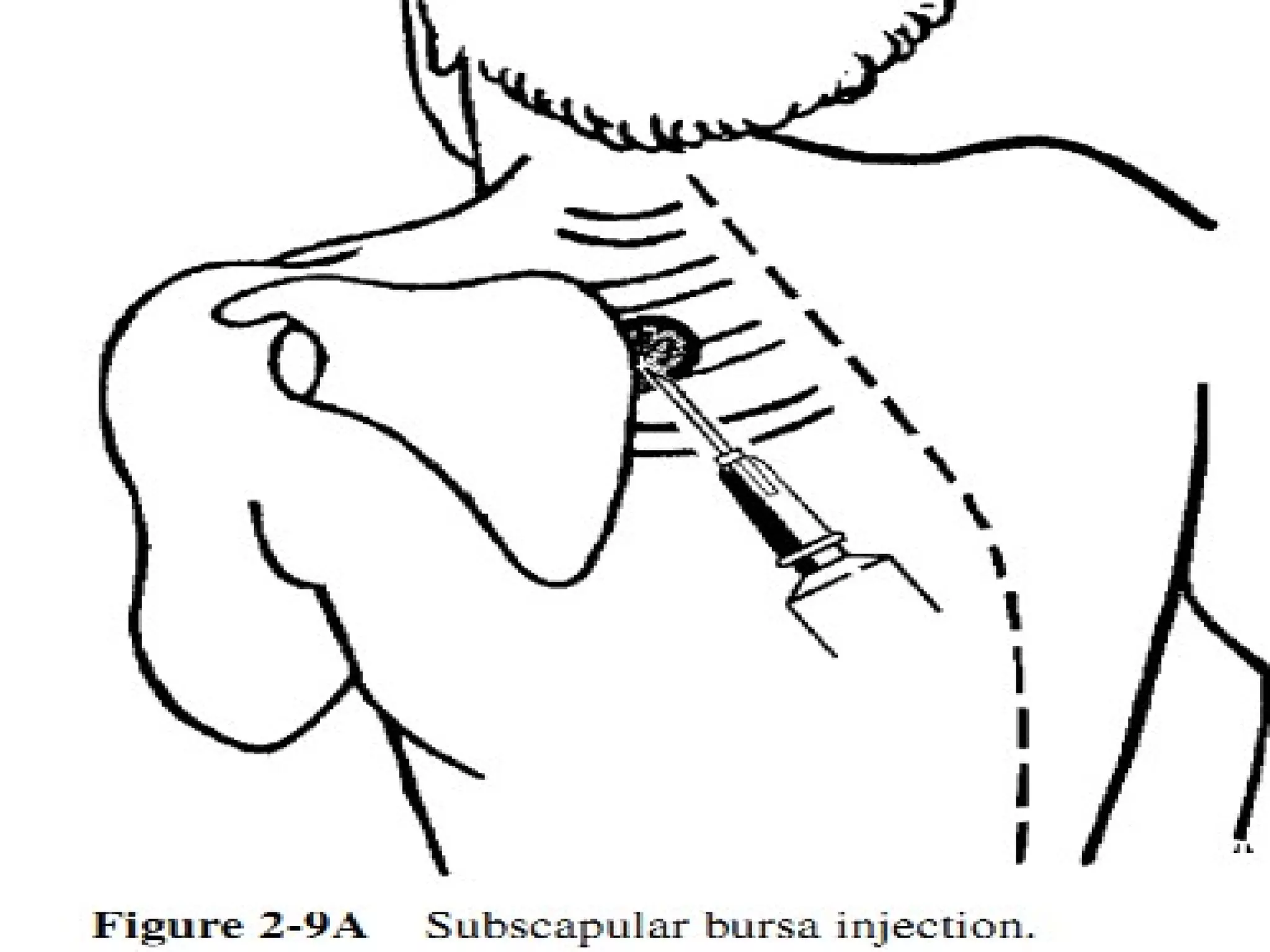 Dr tarek joint and soft tissue injections (1) | PPT