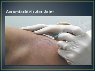 Tac Injection Dr tarek joint and soft tissue injections (1) | PPT