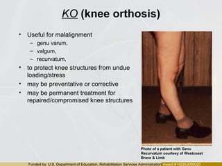 Funded by: U.S. Department of Education, Rehabilitation Services Administration Award # H235J050020
KO (knee orthosis)
• Useful for malalignment
– genu varum,
– valgum,
– recurvatum,
• to protect knee structures from undue
loading/stress
• may be preventative or corrective
• may be permanent treatment for
repaired/compromised knee structures
Photo of a patient with Genu
Recurvatum courtesy of Westcoast
Brace & Limb
 