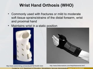 Funded by: U.S. Department of Education, Rehabilitation Services Administration Award # H235J050020
Wrist Hand Orthosis (WHO)
• Commonly used with fractures or mild to moderate
soft tissue sprains/strains of the distal forearm, wrist
and proximal hand
• Maintains wrist in a static position
http://www.wisdomking.com/product215219c361.html http://www.thebonestore.com/HelyWeberwrist.html
 