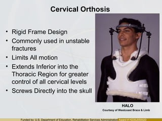 Funded by: U.S. Department of Education, Rehabilitation Services Administration Award # H235J050020
Cervical Orthosis
• Rigid Frame Design
• Commonly used in unstable
fractures
• Limits All motion
• Extends Inferior into the
Thoracic Region for greater
control of all cervical levels
• Screws Directly into the skull
HALO
Courtesy of Westcoast Brace & Limb
 