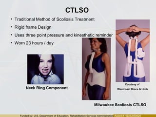 Funded by: U.S. Department of Education, Rehabilitation Services Administration Award # H235J050020
CTLSO
Milwaukee Scoliosis CTLSO
• Traditional Method of Scoliosis Treatment
• Rigid frame Design
• Uses three point pressure and kinesthetic reminder
• Worn 23 hours / day
Neck Ring Component
Courtesy of
Westcoast Brace & Limb
 