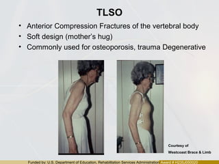 Funded by: U.S. Department of Education, Rehabilitation Services Administration Award # H235J050020
TLSO
• Anterior Compression Fractures of the vertebral body
• Soft design (mother’s hug)
• Commonly used for osteoporosis, trauma Degenerative
Courtesy of
Westcoast Brace & Limb
 