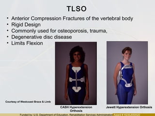Funded by: U.S. Department of Education, Rehabilitation Services Administration Award # H235J050020
TLSO
• Anterior Compression Fractures of the vertebral body
• Rigid Design
• Commonly used for osteoporosis, trauma,
• Degenerative disc disease
• Limits Flexion
Jewett Hyperextension OrthosisJewett Hyperextension OrthosisCASH Hyperextension
Orthosis
Courtesy of Westcoast Brace & Limb
 