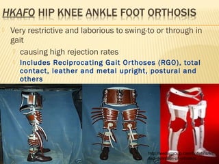 Orthotics Definition Dr tarek orthotic overview | PPT