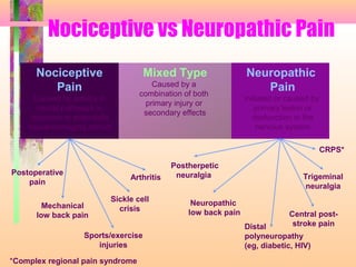 Mixed Type
Caused by a
combination of both
primary injury or
secondary effects
Nociceptive vs Neuropathic Pain
Nociceptive
Pain
Caused by activity in
neural pathways in
response to potentially
tissue-damaging stimuli
Neuropathic
Pain
Initiated or caused by
primary lesion or
dysfunction in the
nervous system
Postoperative
pain
Mechanical
low back pain
Sickle cell
crisis
Arthritis
Postherpetic
neuralgia
Neuropathic
low back pain
CRPS*
Sports/exercise
injuries
*Complex regional pain syndrome
Central post-
stroke pain
Trigeminal
neuralgia
Distal
polyneuropathy
(eg, diabetic, HIV)
 