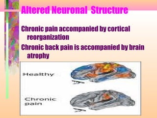 Altered Neuronal Structure
Chronic pain accompanied by cortical
reorganization
Chronic back pain is accompanied by brain
atrophy
 