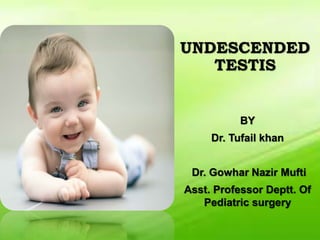 UNDESCENDED
TESTIS
BY
Dr. Tufail khan
Dr. Gowhar Nazir Mufti
Asst. Professor Deptt. Of
Pediatric surgery
 