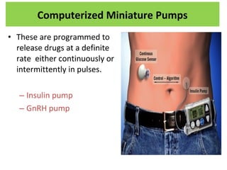 • These are programmed to
release drugs at a definite
rate either continuously or
intermittently in pulses.
– Insulin pump
– GnRH pump
Computerized Miniature Pumps
 