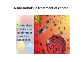 Nano-Robots in treatment of cancer.
 
