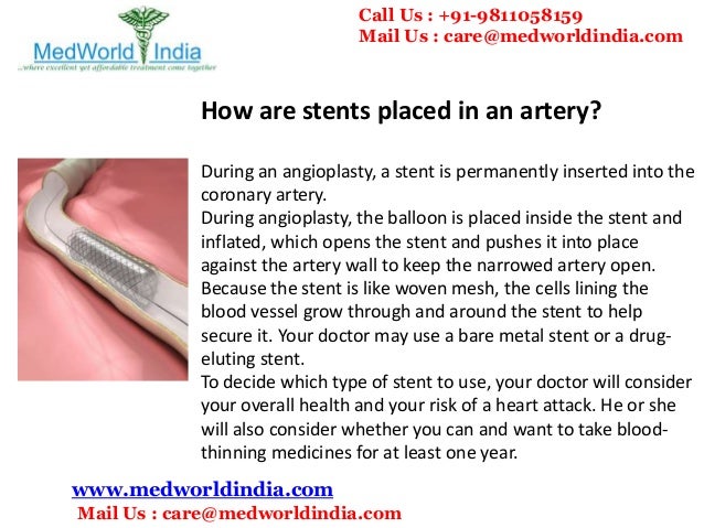 second generation drug eluting stents essay second generation drug eluting stents essay
