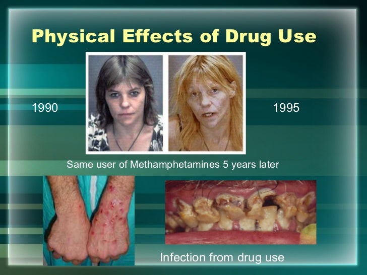 Harmful effects of drugs and classification image