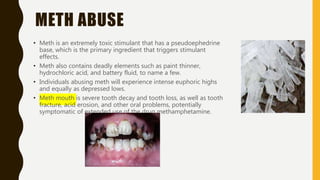 Drug abuse | PDF