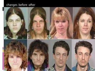 changes before -after
 