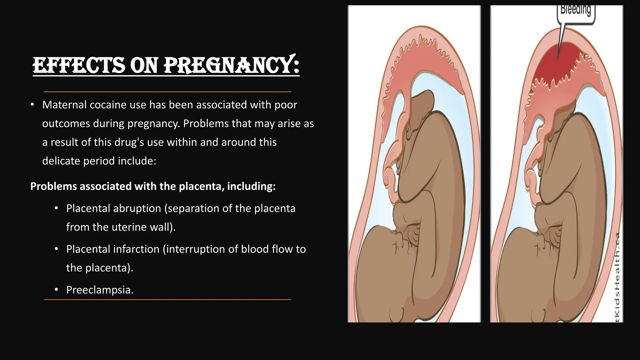 What are the benefits and risks of eating placenta? - Can I Have Spicy Food During Placental Abruption