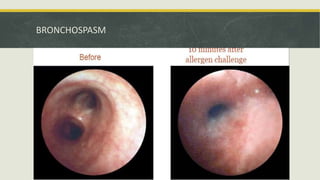 Drug acting on respiratory system | PPTX