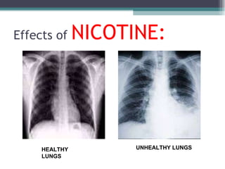 Effects of  NICOTINE: HEALTHY LUNGS UNHEALTHY LUNGS 