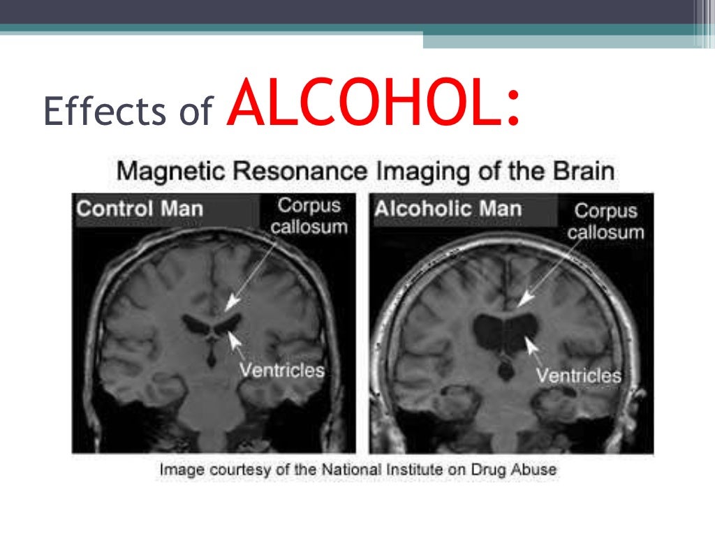 Drug Addiction Ppt