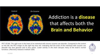 3/3/2020 2
PET SCAN: The right scan is the brain of an individual with chronic cocaine use disorder. Compared to the control
on the left, the PET image on the right has less red, indicating that the brain of the individual with cocaine use
disorder has less glucose and is less active. Lower activity in the brain disrupts many of the brain's normal
functions. (Recovery research Institute USA)
Control On Cocaine
Addiction is a disease
that affects both the
Brain and Behavior
 