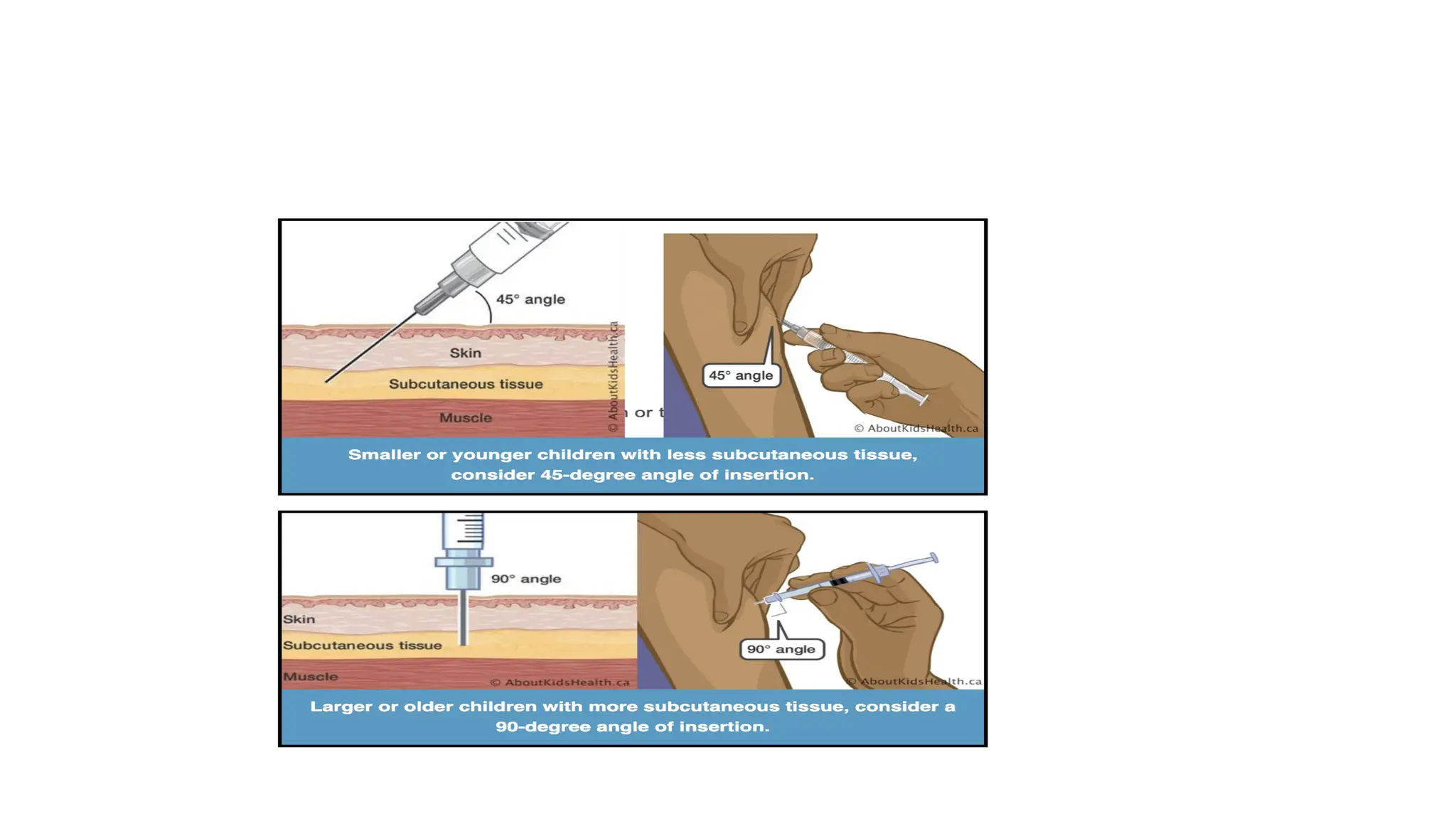Transversal Injection Drug administration & Blood transfusion.pptx
