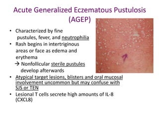 Drug Allergy-Diagnosis and Treatment .ppt