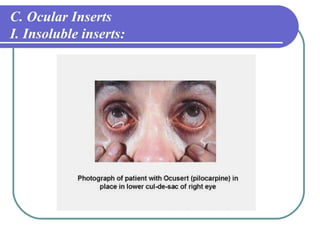 Drug delivery&contact lens | PPT