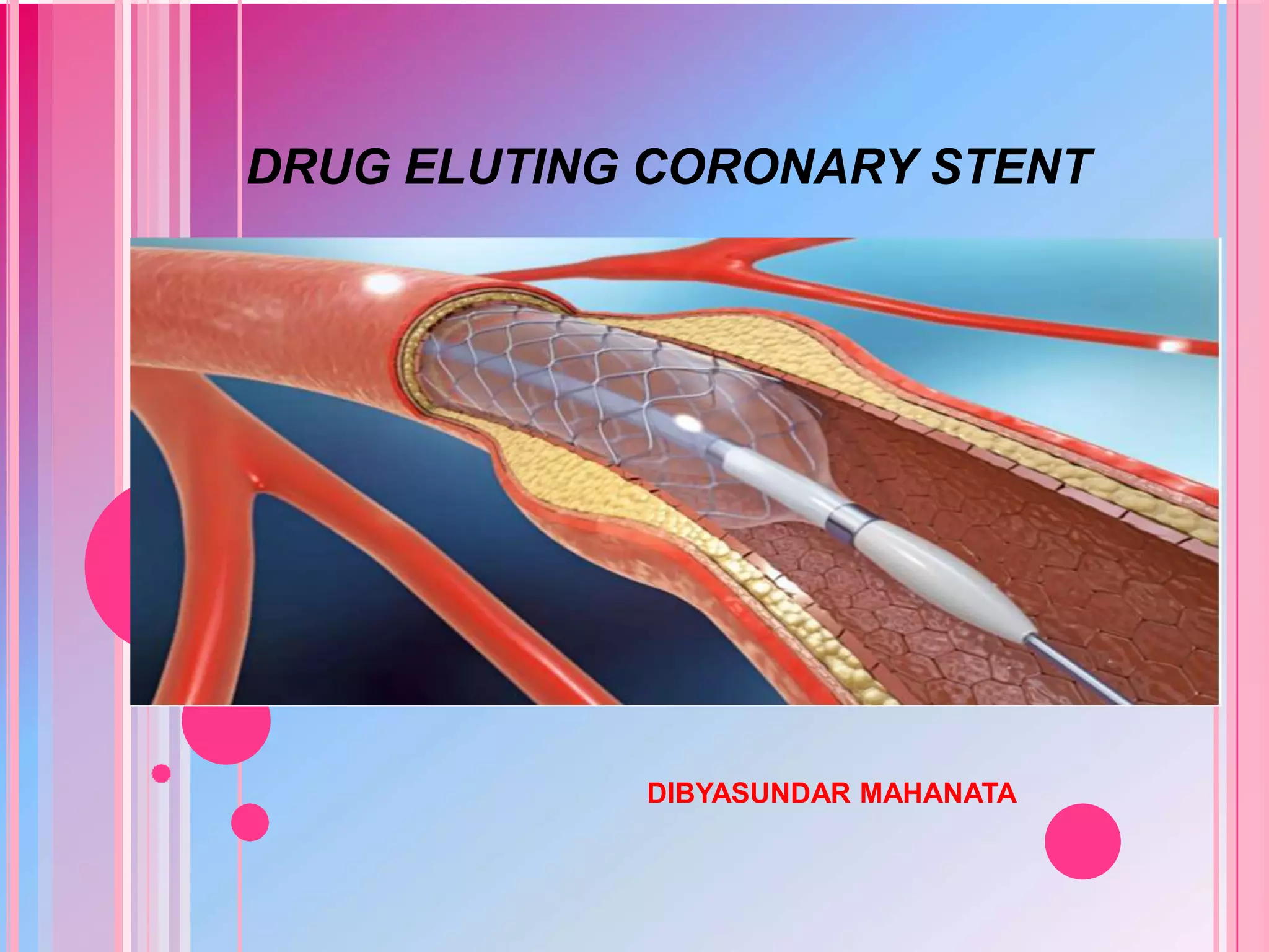 Is Silk Road Stent Drug Eluting Drug eluting stent | PPT