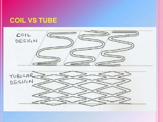 COIL VS TUBE
 