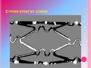 CYPHER STENT BY CORDIS
 