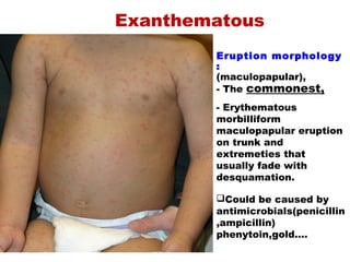 Eruption morphology
:
(maculopapular),
- The commonest,
- Erythematous
morbilliform
maculopapular eruption
on trunk and
extremeties that
usually fade with
desquamation.
Could be caused by
antimicrobials(penicillin
,ampicillin)
phenytoin,gold….
Exanthematous
 