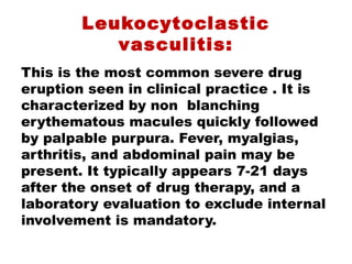 Leukocytoclastic
vasculitis:
This is the most common severe drug
eruption seen in clinical practice . It is
characterized by non blanching
erythematous macules quickly followed
by palpable purpura. Fever, myalgias,
arthritis, and abdominal pain may be
present. It typically appears 7-21 days
after the onset of drug therapy, and a
laboratory evaluation to exclude internal
involvement is mandatory.
 