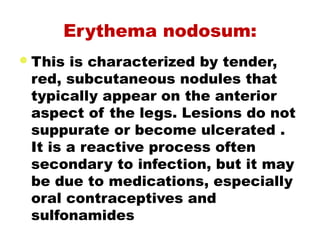 Erythema nodosum:
This is characterized by tender,
red, subcutaneous nodules that
typically appear on the anterior
aspect of the legs. Lesions do not
suppurate or become ulcerated .
It is a reactive process often
secondary to infection, but it may
be due to medications, especially
oral contraceptives and
sulfonamides
 