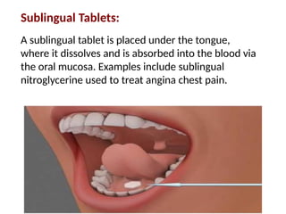 Sublingually drug forms (also called dosage forms), we mean the physical form in ...