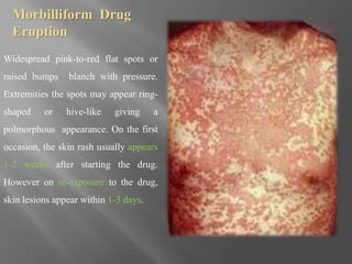 Mobillifom Rash Drug allergy | PPTX