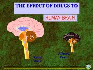 THE EFFECT OF DRUGS TO  Normal Brain Affected Brain HUMAN BRAIN 