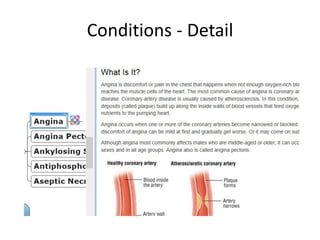 Conditions - Detail